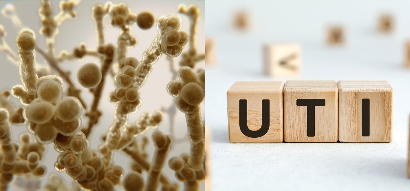 Split image showing microscopic yeast cells on the left and wooden blocks spelling UTI on the right, illustrating the connection between yeast infections and urinary tract infections.