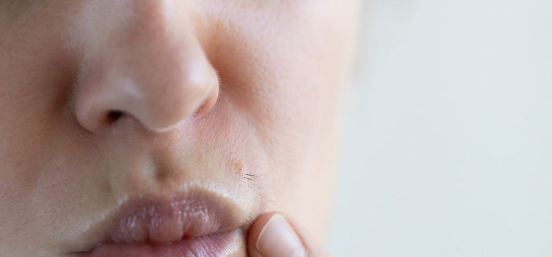 Close-up of a person's lower face showing a few dark hairs growing on the upper lip near a small mole.