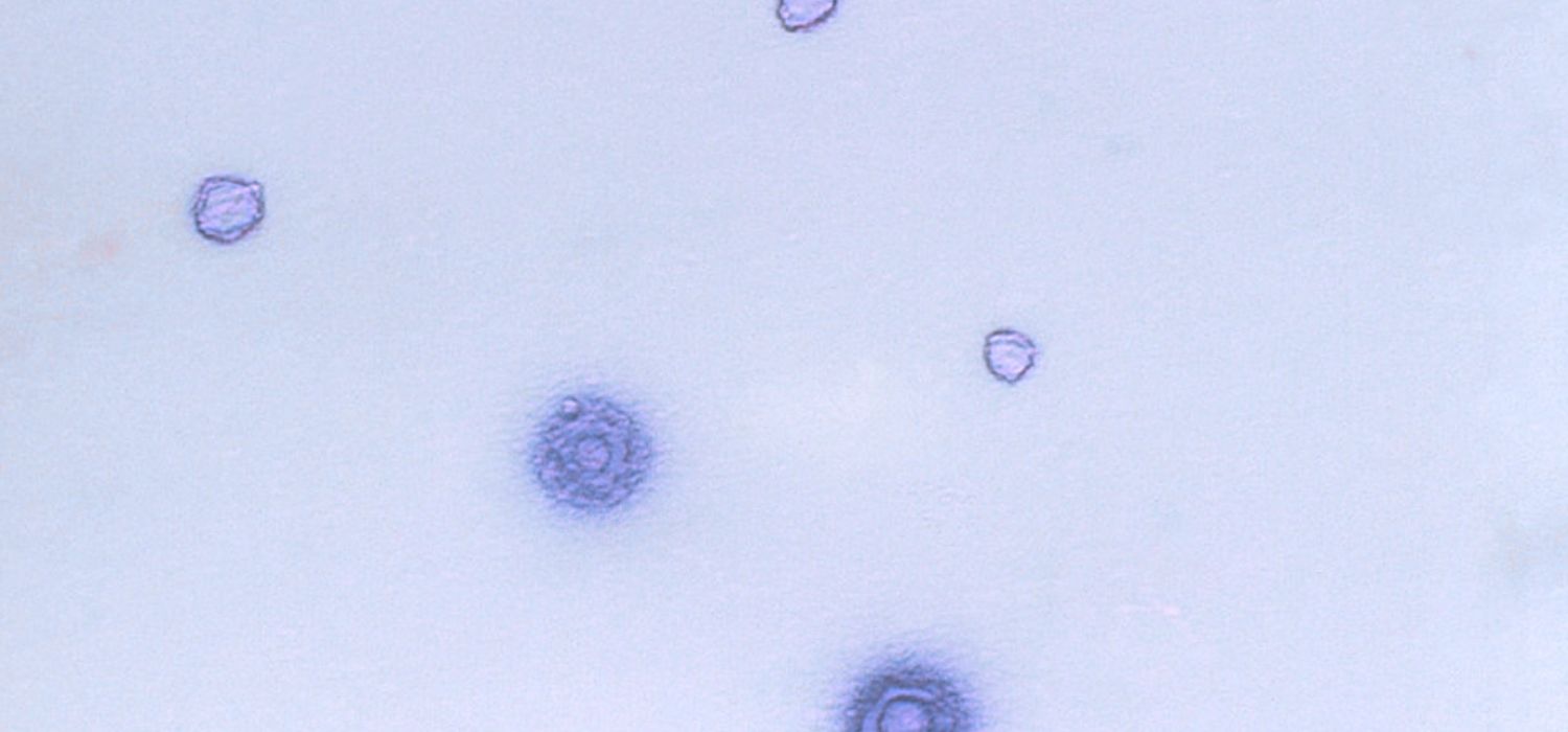 A microscopic image of mycoplasma hominis bacteria.