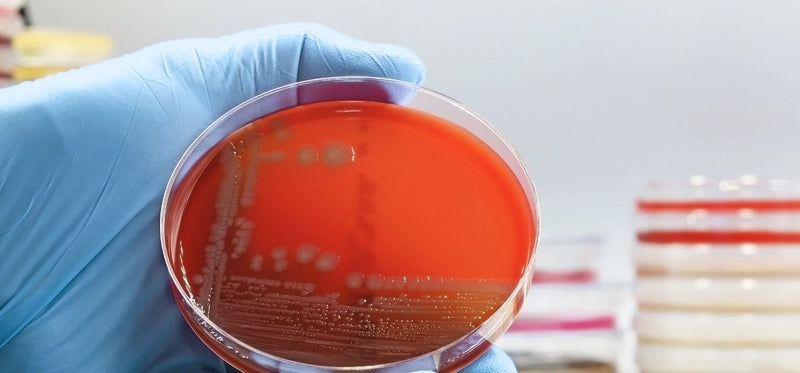 A close up image of a person holding a Petri dish with bacteria culture.