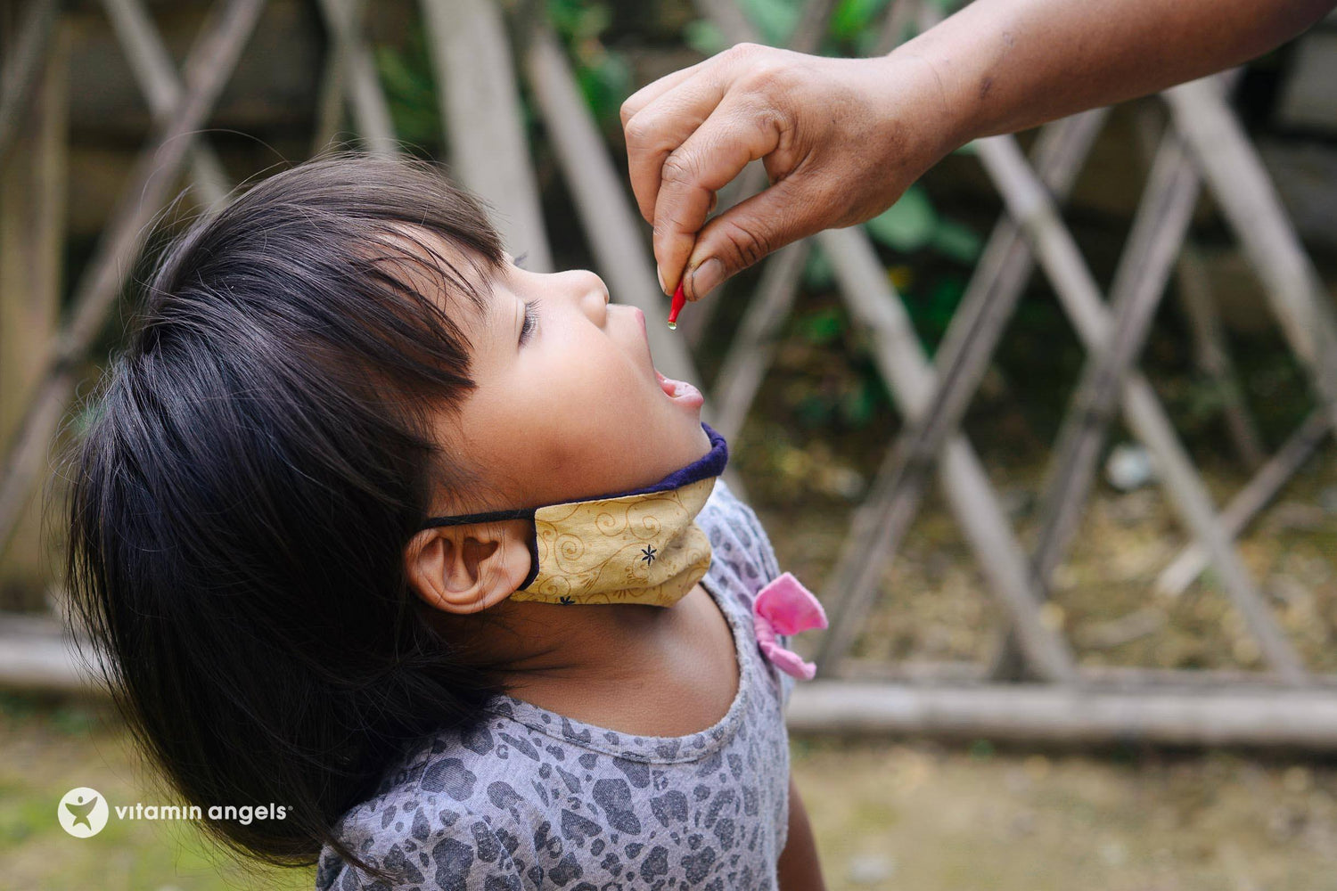 A young girl receiving liquid vitamin drops, part of the Vitamin Angel campaign.