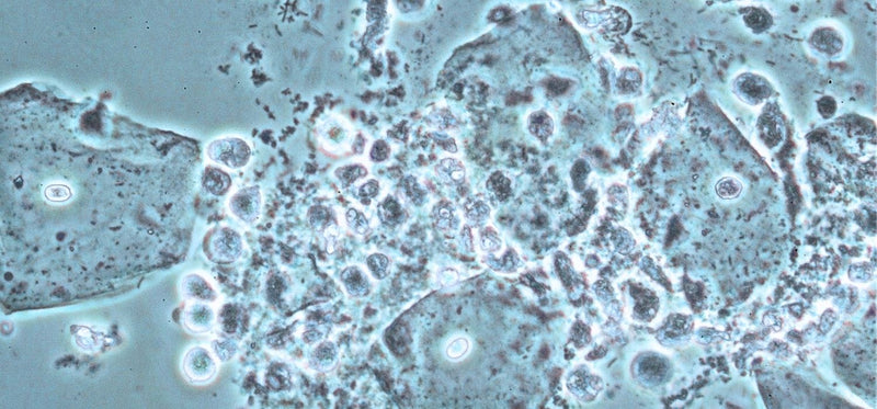 A microscopic image of aerobic bacteria overgrowth, which can cause aerobic vaginitis.