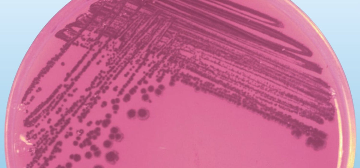 A magenta-colored petri dish with bacterial cultures growing in streaks and clusters.
