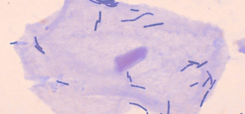 What Is Lactobacillus, And Can It Help Treat BV?