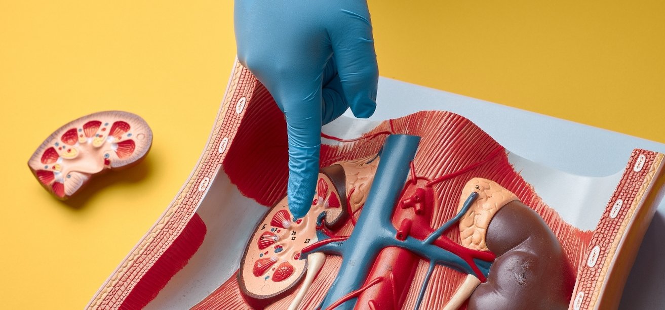 An anatomical model of the human urinary system on a yellow background, showing a hand in a blue medical glove pointing at the cross-section of a kidney.